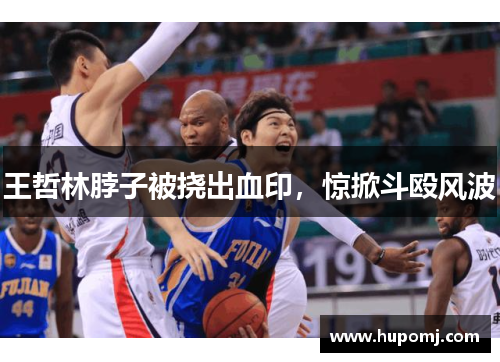 王哲林脖子被挠出血印，惊掀斗殴风波